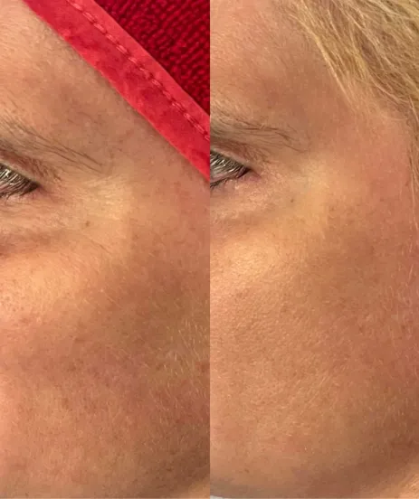 Soin Instant Beauty Guinot - Infusion de jeunesse